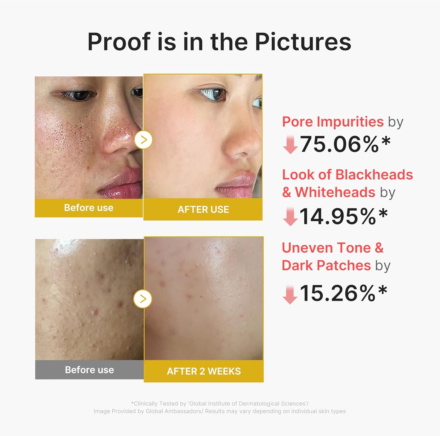 Medicube Kojic Acid Turmeric Face Peel Shot 80ml